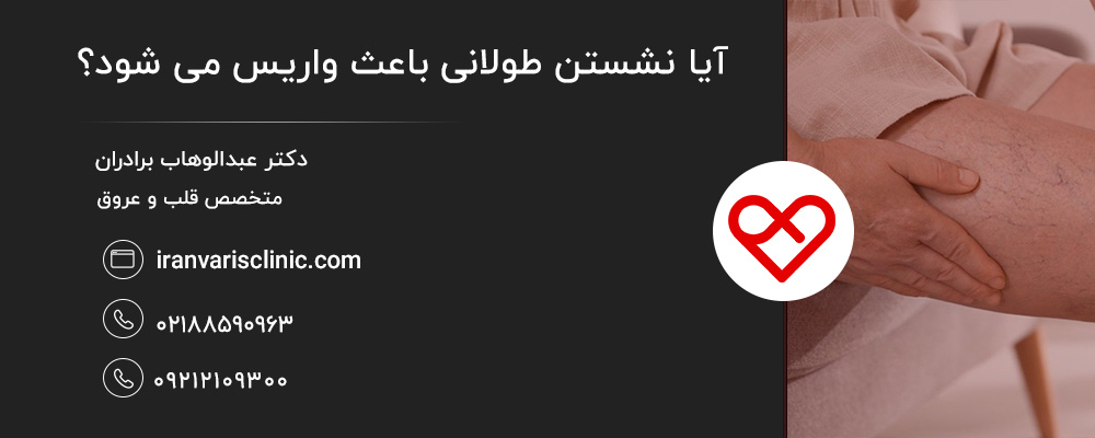 آیا واریس ناشی از نشستن قابل درمان است؟