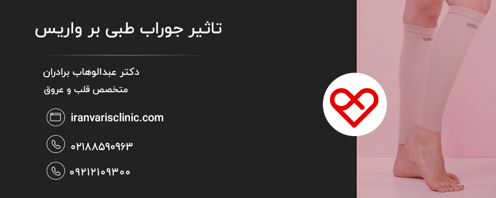 ارتباط جوراب طبی و واریس