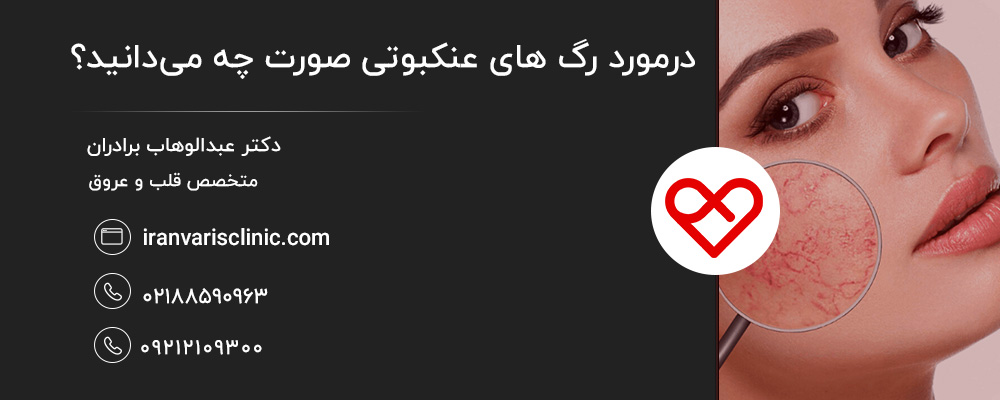 راههای درمان رگهای عنکبوتی صورت
