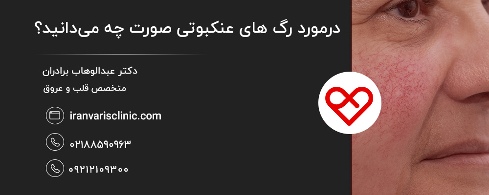 علت ایجاد رگهای عنکبوتی صورت چیست؟