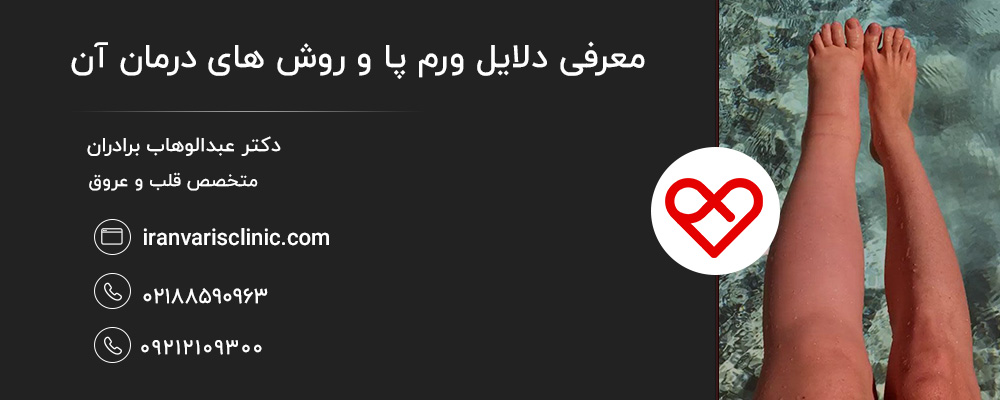 چرا پاها ورم میکنند؟