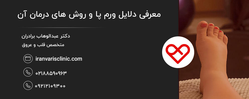 بارداری از شایع ترین علل ورم پاها در خانم ها