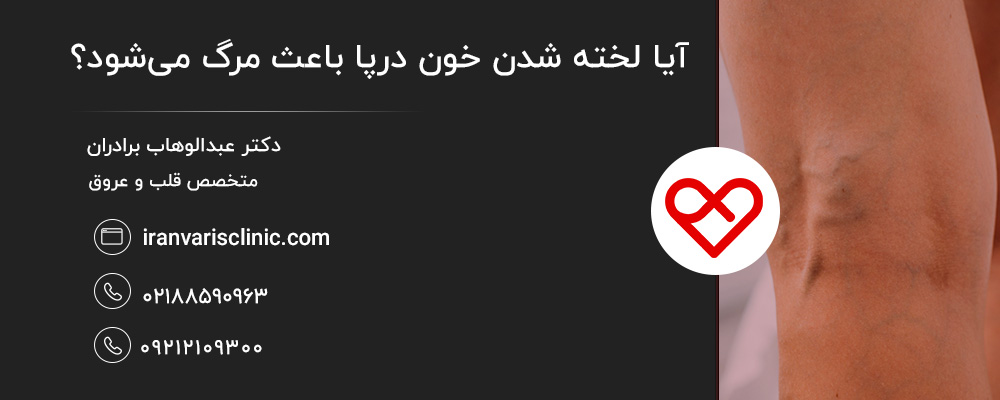 دلایل و عوامل خطر لخته شدن خون در پا