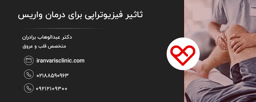 آیا فیزیوتراپی برای درمان واریس مناسب است؟