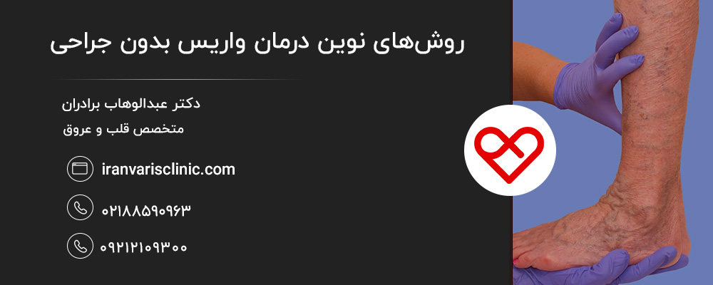 واریس چیست و چرا باید درمان شود؟