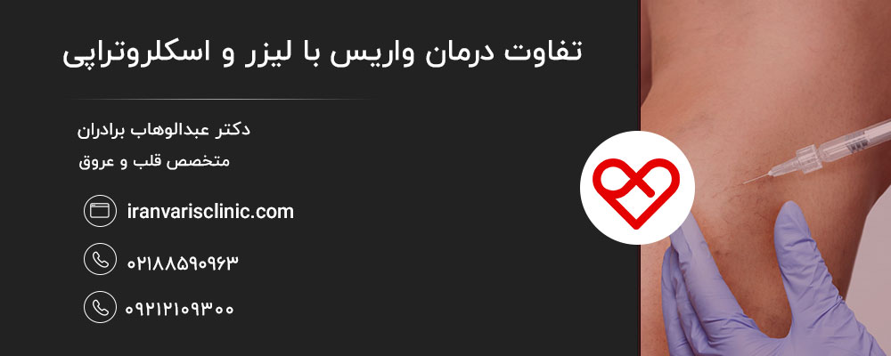 مراقبتهای بعد از درمان واریس (لیزر و اسکلروتراپی)