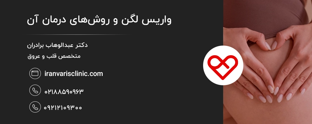 واریس لگن و روشهای درمان آن
