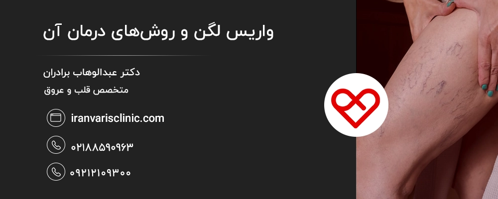 واریس لگن و روشهای درمان آن