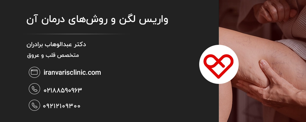 واریس لگن و روشهای درمان آن