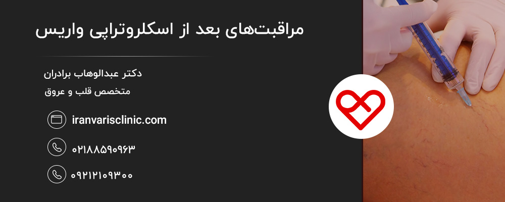 عوارض شایع بعد از اسکلروتراپی