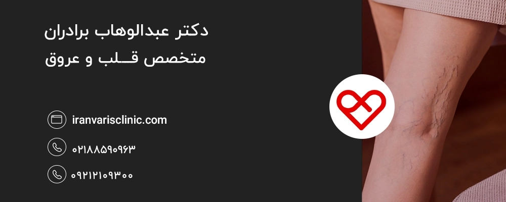 بررسی تاثیرات گرما بر واریس