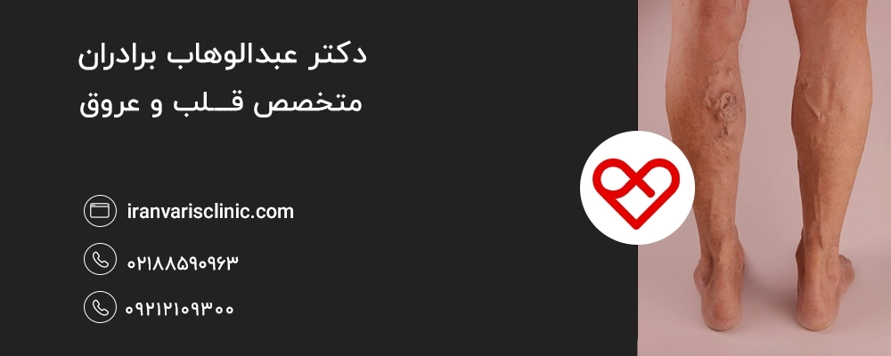 نکات کاربردی برای کنترل واریس در شرایط آبوهوایی مختلف