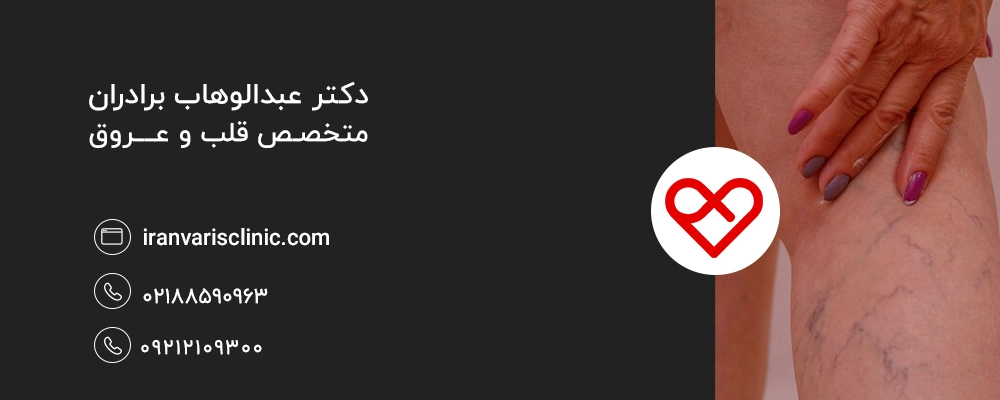 نکات مهم در استفاده از کرم ونوویتال برای درمان واریس 