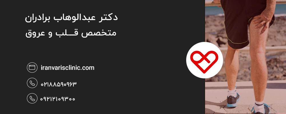 واریس پشت زانو چیست؟