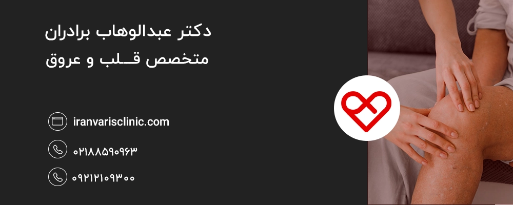 علائم خطرناک واریس در بیماران دیابتی