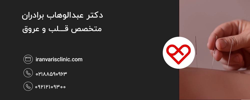 چگونه طب سوزنی بر واریس اثر می‌گذارد؟
