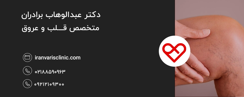  نکاتی برای کاهش تأثیر منفی کافئین بر واریس