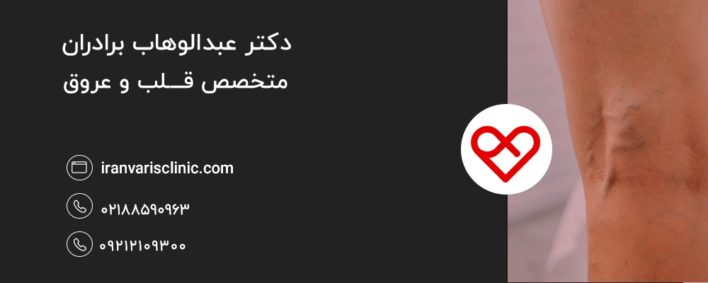 روش‌ های درمان واریس طنابی کدامند؟