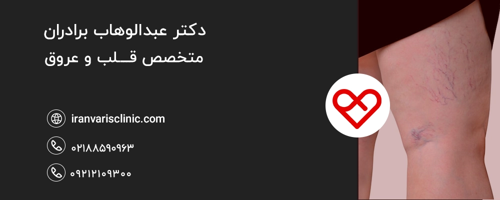  چطور کم‌آبی بدن می‌تواند واریس را تشدید کند؟