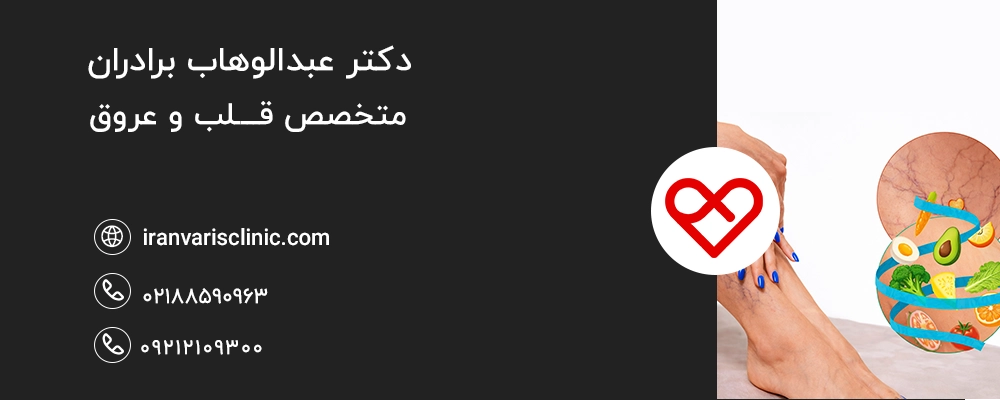 ارتباط تغذیه با پیشگیری از بازگشت واریس