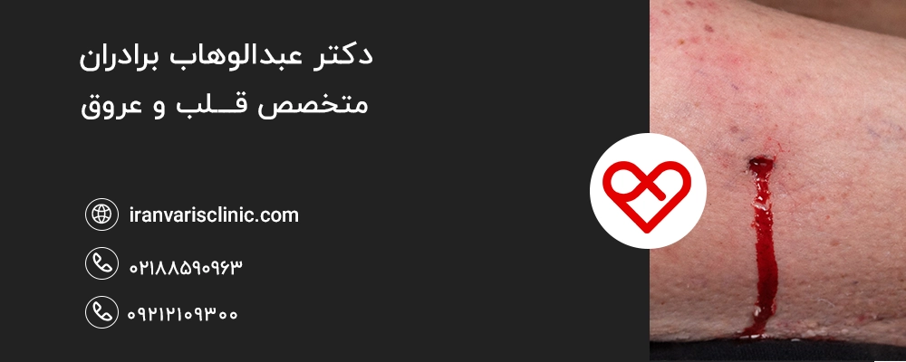 خونریزی ناگهانی از رگ‌های واریسی