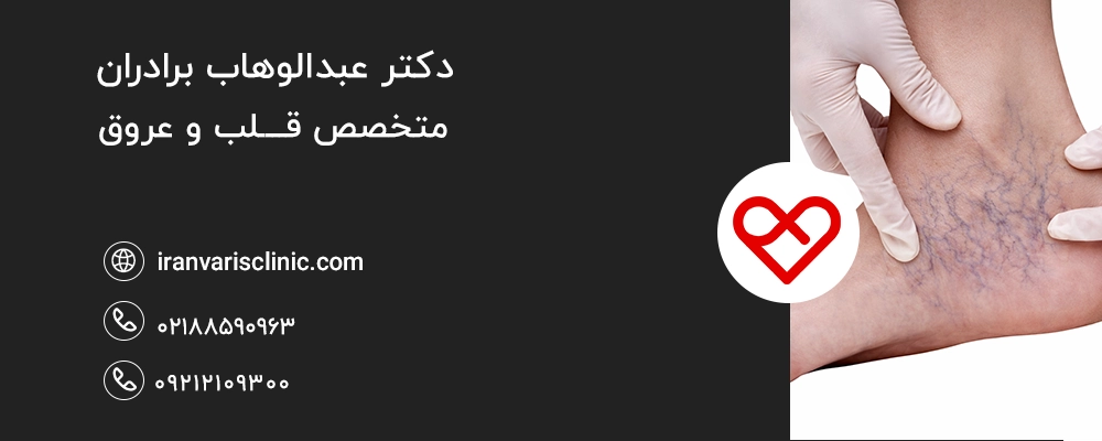 اهمیت تشخیص و درمان به‌ موقع واریس