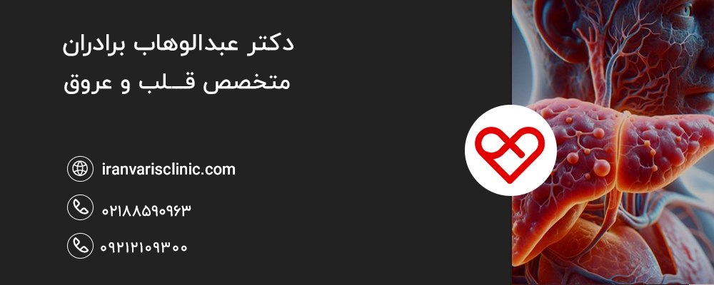  نقش کبد در ایجاد ورم و مشکلات وریدی