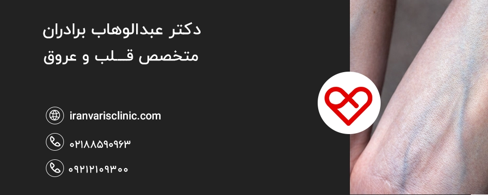 چرا رگها سبز دیده میشوند؟