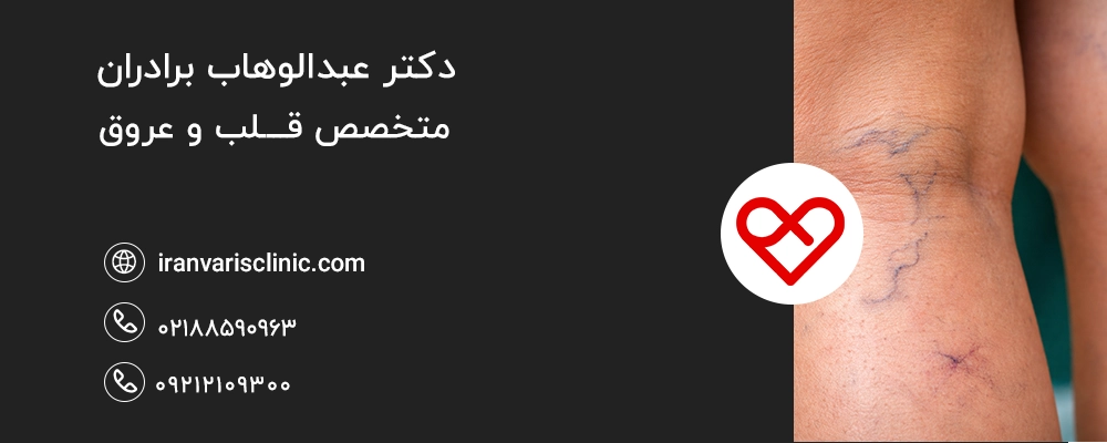 چه زمانی سبز شدن رگها نگرانکننده است؟