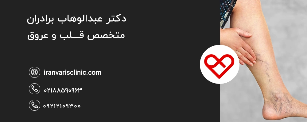 مزایای درمان واریس با آب نمک
