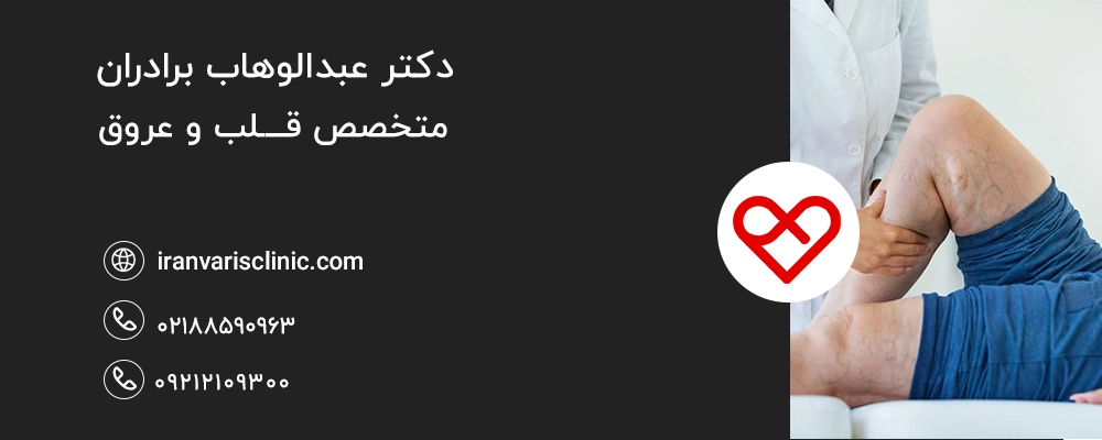  نکات کلیدی برای کاهش خطر همزمان یبوست و واریس
