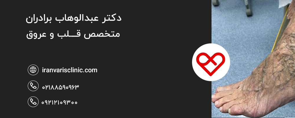 چه افرادی نباید از درمان واریس با آب نمک استفاده کنند؟