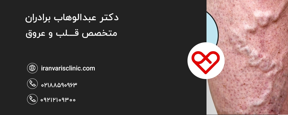  واریس چیست و چرا ایجاد می‌شود؟