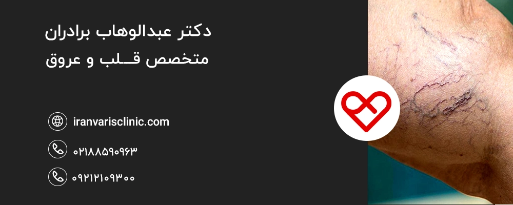  واریس و اثرات آن بر روان