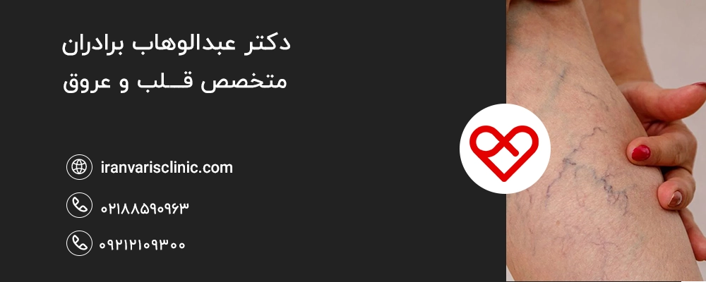  علائم هشداردهنده برای کسانی که یبوست و واریس همزمان دارند