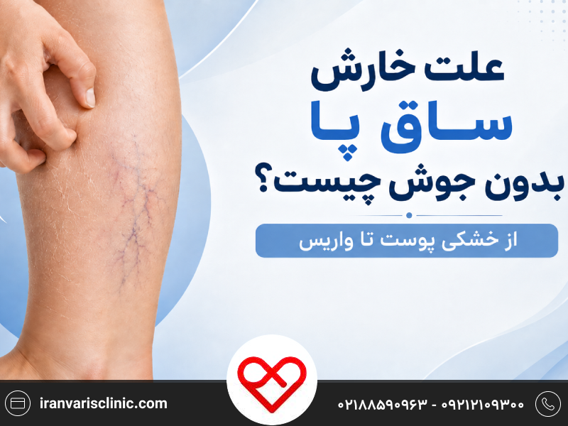 علت خارش ساق پا