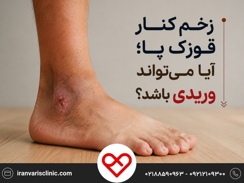 زخم کنار قوزک پا؛ آیا می‌تواند وریدی باشد؟