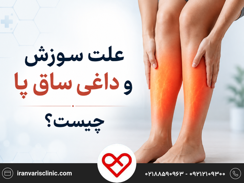 علت سوزش و داغی ساق پا چیست؟