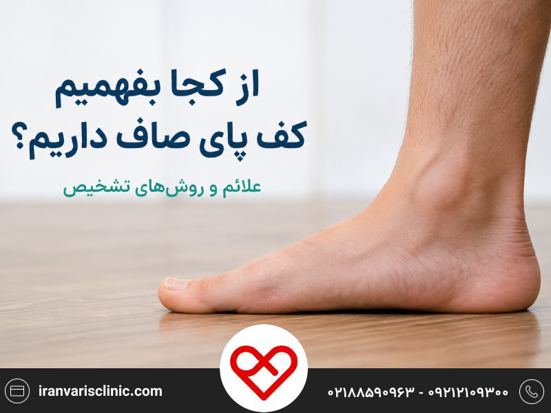 از کجا بفهمیم کف پای صاف داریم؟ علائم و روش‌های تشخیص