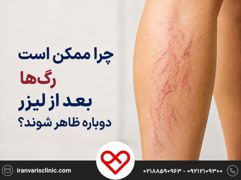 چرا ممکن است رگ‌ها بعد از لیزر دوباره ظاهر شوند؟