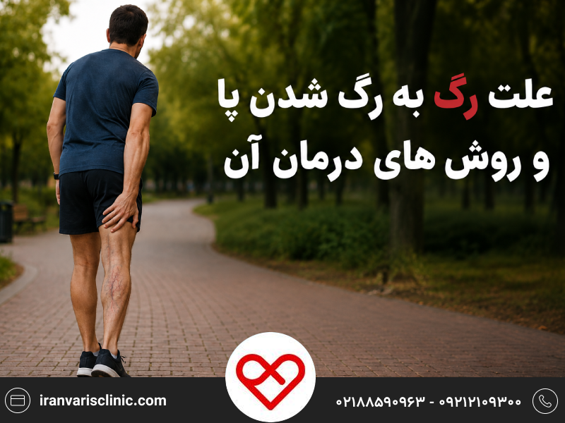 علت رگ به رگ شدن پا و روش های درمان آن
