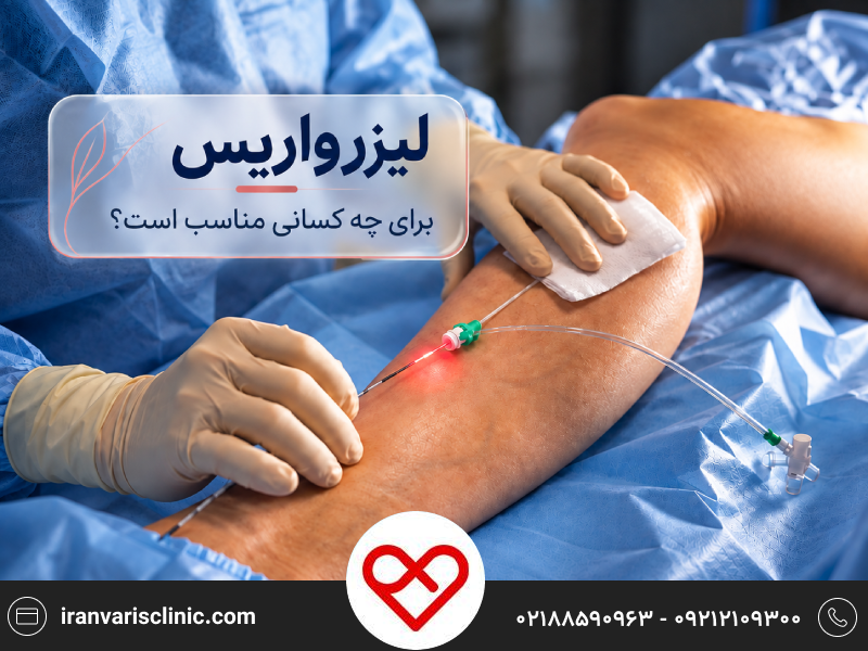 لیزر واریس برای چه کسانی مناسب است؟