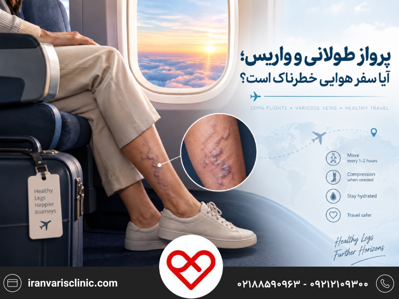 پرواز طولانی و واریس؛ آیا سفر هوایی خطرناک است؟