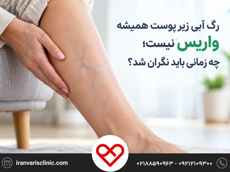 رگ آبی زیر پوست